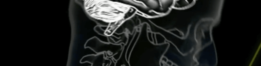 What Is A Concussion?